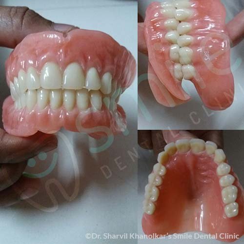 Dentures
