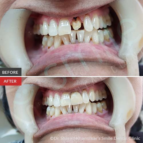 3Cosmetic-Dentistry