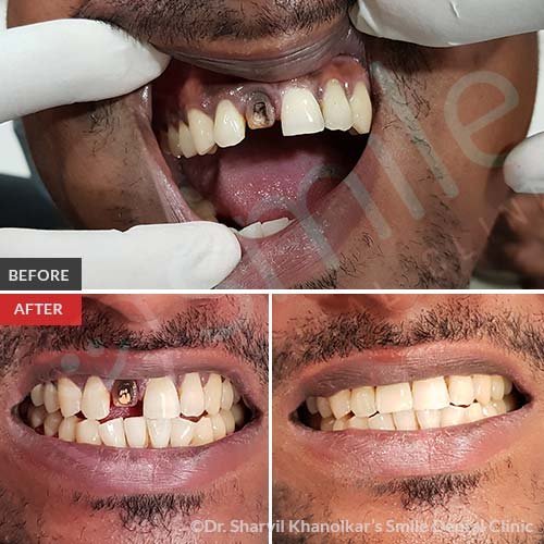 4Cosmetic-Dentistry