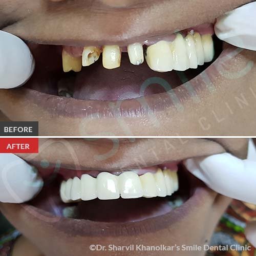 5Cosmetic-Dentistry