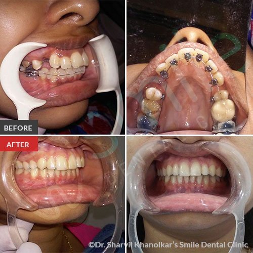 Orthodontics