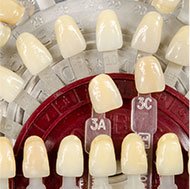 Porcelain Veneers